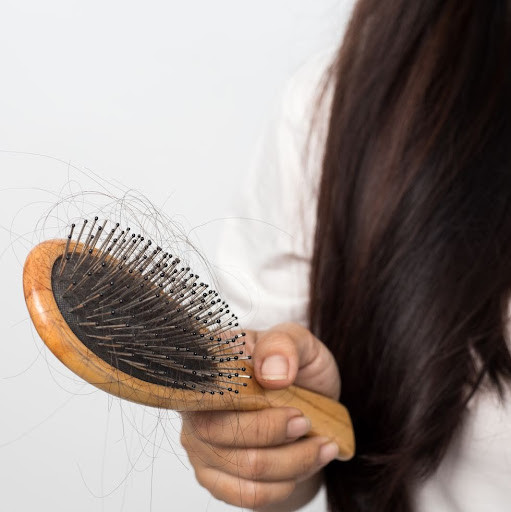 Olika stadier av håravfall